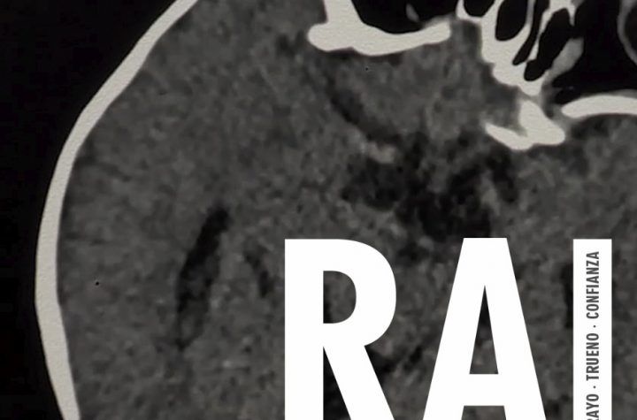Xiaomi Rai