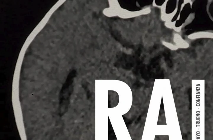 Xiaomi Rai